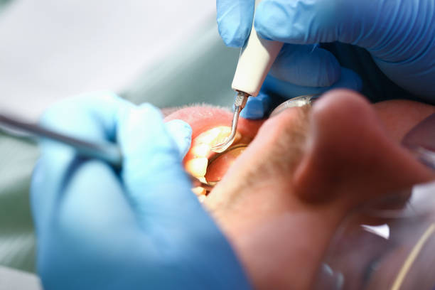 Best Broken or Chipped Tooth Repair in Blacklick Estates, OH