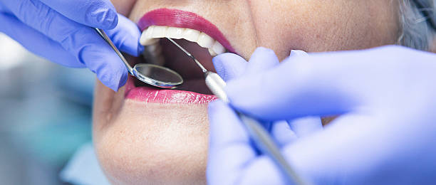 Best Knocked-Out Tooth (Avulsed Tooth) Treatment in Blacklick Estates, OH